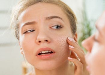 cách điều trị da khô nứt nẻ vào mùa đông tại nhà